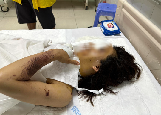 Mu mat vi dung dien thoai dang sac: Bac si khuyen cao gi?