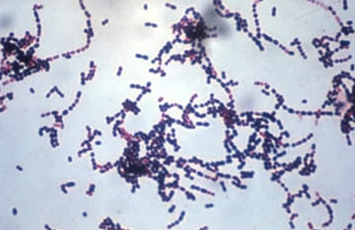 Nhiem lien cau khuan do an long lon: Dau hieu benh de nham lan-Hinh-2