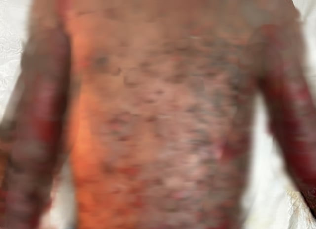 Nam thanh nien mac benh hiem on dinh trong ngay xuat vien-Hinh-2