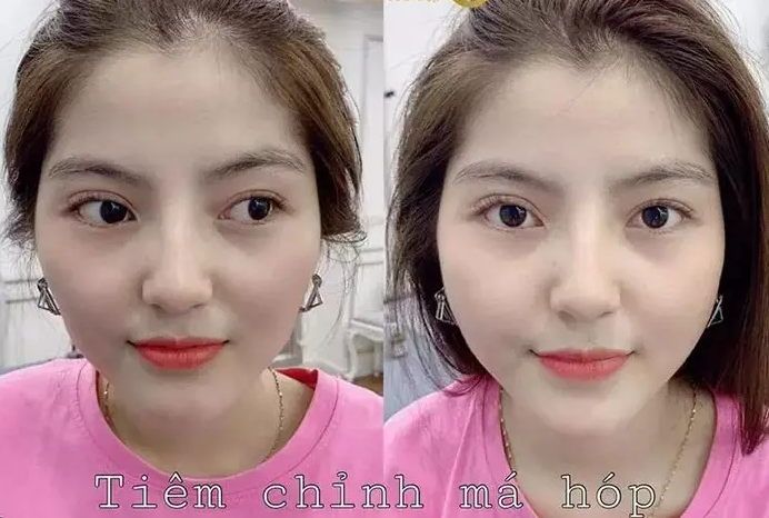 Ngoài ra nhìn những hình ảnh của Thanh Huyền ngày xưa cũng có thể thấy cô nàng đã can thiệp răng, 2 chiếc răng khểnh không còn nữa.