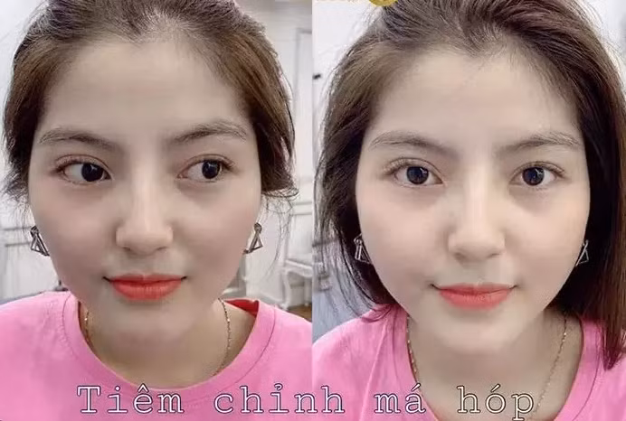 Ngoài ra nhìn những hình ảnh của Thanh Huyền ngày xưa cũng có thể thấy cô nàng đã can thiệp răng, 2 chiếc răng khểnh không còn nữa.