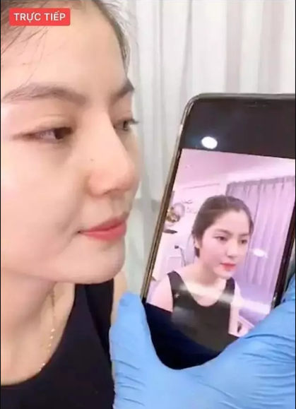 Theo đó Chu Thanh Huyền từng can thiệp "dao kéo" mũi và tiêm chỉnh má để có vẻ ngoài như mong muốn.