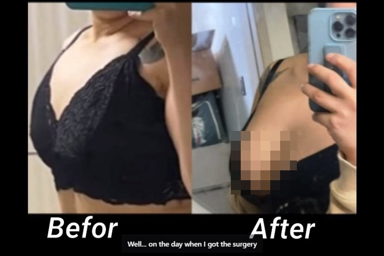 "Thánh ăn" đã một lần nói hết về mọi đồn thổi của cư dân mạng gần đây về vóc dáng của mình. Cô cho rằng, đã có nhiều người tinh ý nhận ra, vòng 1 của cô căng tròn và nảy nở hơn trước.