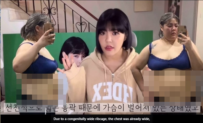 Từng công khai quá trình giảm cân một cách tự nhiên, nói không với dao kéo nhưng giờ, Yang Soobin đã thay đổi quan điểm đó.