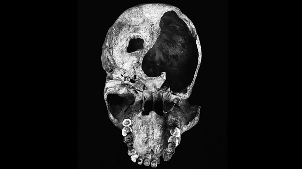 Một hiện vật ở bảo tàng lịch sử tự nhiên London, Anh đã đặt ra một bí ẩn chưa có lời giải. Đó là một cái sọ người có niên đại khoảng 130.000 đến 300.000 năm. Bên trái của nó có một lỗ nhỏ, trông rất giống như một vết đạn đi xuyên qua.