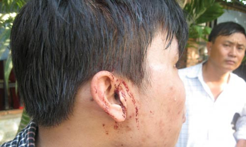 Vu phong vien bi hanh hung: Nan nhan bi am anh kinh hoang-Hinh-2