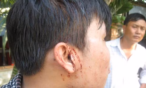 Vu phong vien bi hanh hung: Nan nhan bi am anh kinh hoang-Hinh-2