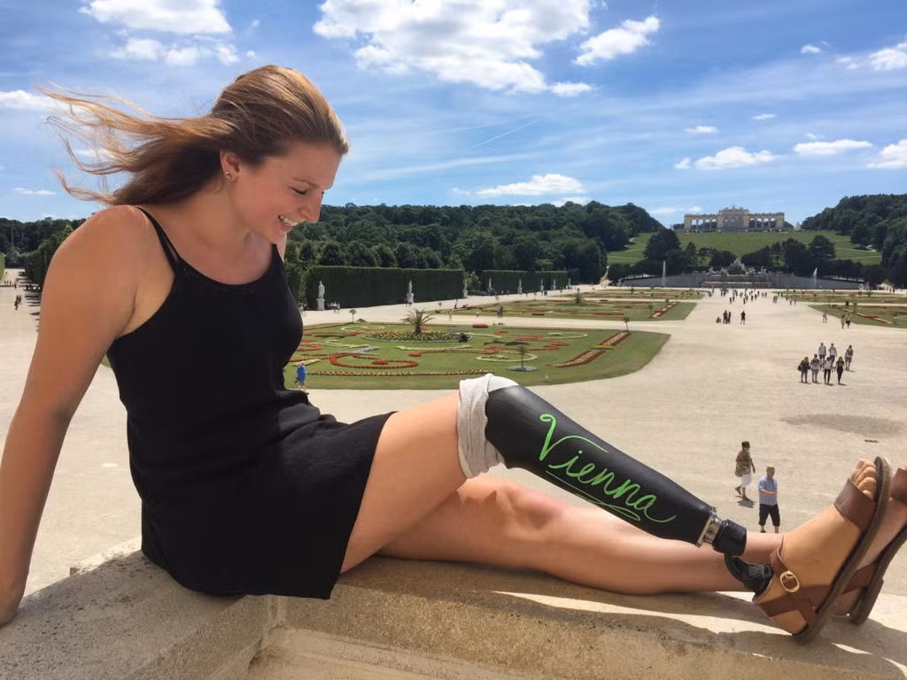 Mặc dù không được thoải mái và có chút khó khăn khi hoạt động, người đẹp một chân chưa bao giờ cảm thấy tự ti hay xấu hổ.