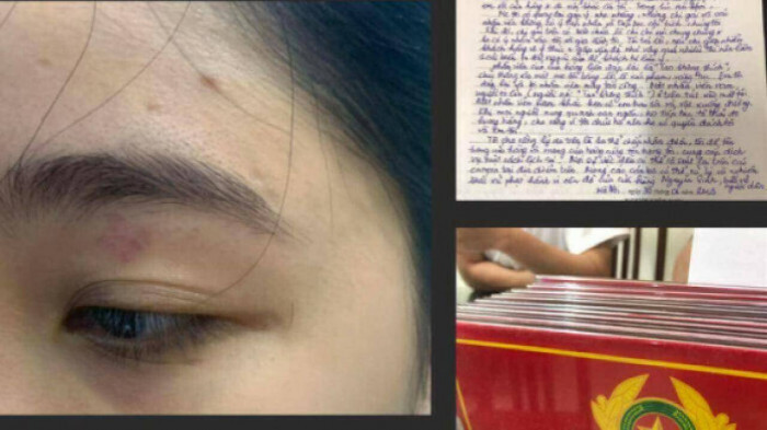 Phat 13 trieu dong 2 nhan vien quan banh mi Nguyen Sinh danh khach