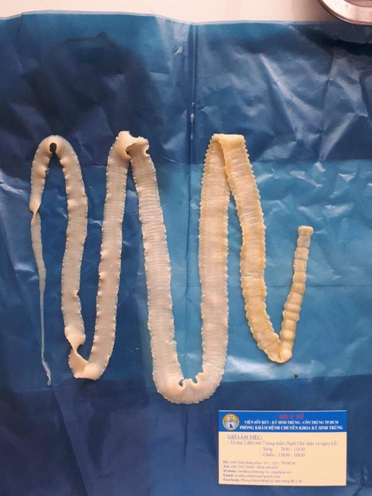 Loại sán gắp ra từ thịt heo tại các địa phương trên