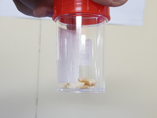 Hy huu nhung ca hoc di vat nguy hiem o Viet Nam