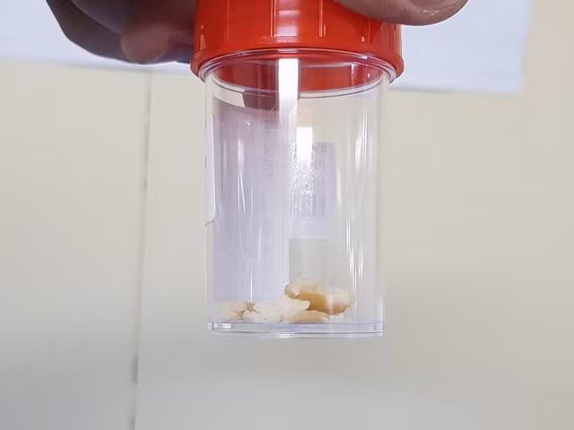 Hy huu nhung ca hoc di vat nguy hiem o Viet Nam