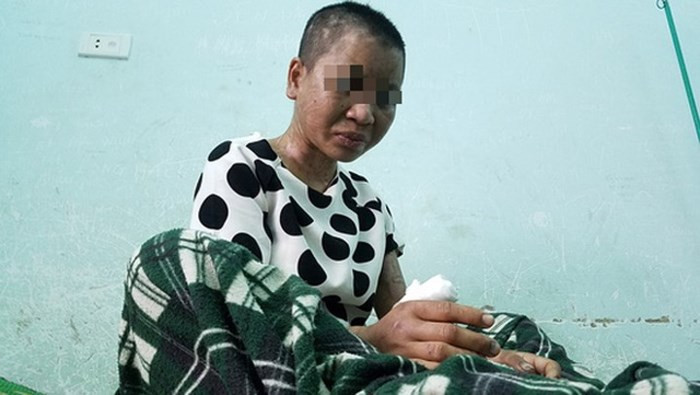 Cũng theo luật sư Dương Lê Sơn, với những thông tin ban đầu, có thể bà Nga bị điều tra 2 tội: Tội "Cố ý gây thương tích" với nhiều tình tiết tăng nặng như phạm tội nhiều lần, dùng vũ khí nguy hiểm, côn đồ, dã man; và tội "Hành hạ người khác" theo Điều 140 Bộ luật Hình sự.(Ảnh: Người Lao Động). Cũng theo luật sư Dương Lê Sơn, với những thông tin ban đầu, có thể bà Nga bị điều tra 2 tội: Tội "Cố ý gây thương tích" với nhiều tình tiết tăng nặng như phạm tội nhiều lần, dùng vũ khí nguy hiểm, côn đồ, dã man; và tội "Hành hạ người khác" theo Điều 140 Bộ luật Hình sự.(Ảnh: Người Lao Động).