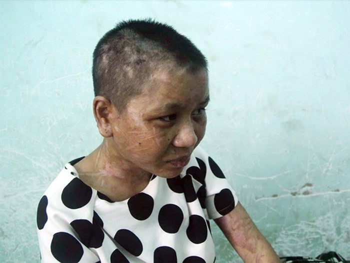 Thông tin trên phapluatplus.vn cho biết, Công an TP. Pleiku, Gia Lai đang tạm giữ bà Nga (39 tuổi, phường Thống Nhất, TP Pleiku) để làm rõ vụ việc. (Ảnh: Zing). Thông tin trên phapluatplus.vn cho biết, Công an TP. Pleiku, Gia Lai đang tạm giữ bà Nga (39 tuổi, phường Thống Nhất, TP Pleiku) để làm rõ vụ việc. (Ảnh: Zing).