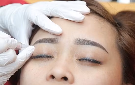 Tu vong bat thuong sau khi xam long may va moi