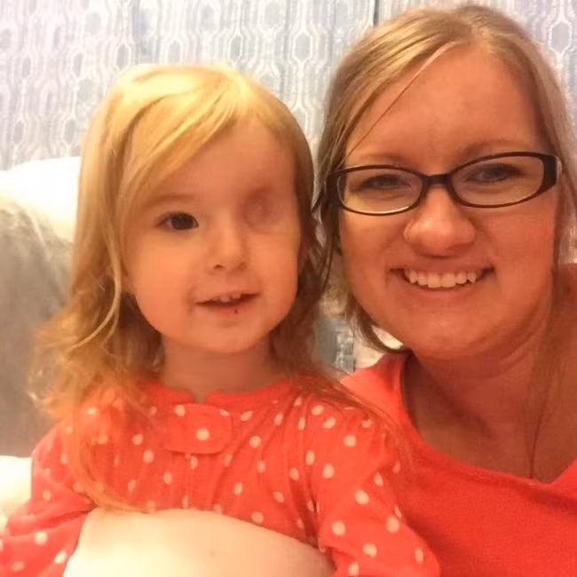 Cô bé mất mắt vì ung thư, điều người mẹ làm gây bất ngờ - Hình 2 Co be mat mat vi ung thu, dieu nguoi me lam gay bat ngo-Hinh-2