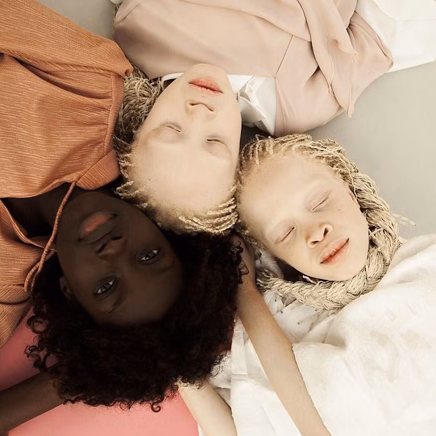 Trong ảnh là Sheila, Lara và Mara, nằm sát bên nhau, gắn kết như một khối không tách rời. (Nguồn Bored Panda)