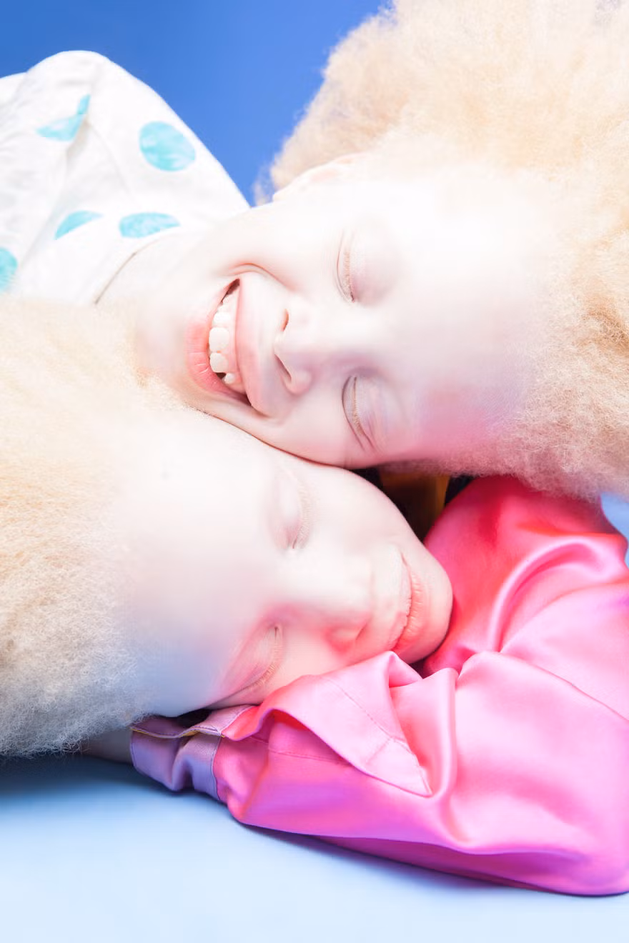 Flores Raras ghi lại những khoảnh khắc đẹp lạ lẫm của cặp chị em song sinh Lara và Mara. (Nguồn Bored Panda)