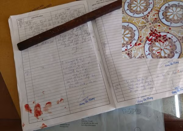 Ha Noi: Bac si bi nguoi nha benh nhan danh bat tinh-Hinh-2