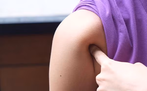 Được biết, với khả năng xoay khớp xương kỳ lạ của mình, Vương Sở hoàn toàn có thể kiếm được hàng trăm triệu nếu như trở thành hot girl ảo, thành lập room chat và biểu diễn khả năng đặc biệt của mình. Tuy nhiên, cô nàng từ chối vì không muốn trở thành một dị nhân kỳ quặc trong mắt người đời. Cô cũng không muốn là thú tiêu khiển của người khác, kiếm tiền trên sự tò mò của họ. (Nguồn Sina)