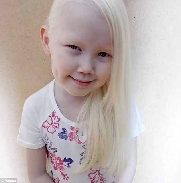 Tâm hồn của Nariyana cũng tinh khiết giống hệt như làn da, mái tóc của cô bé vậy. (Nguồn Dailymail)