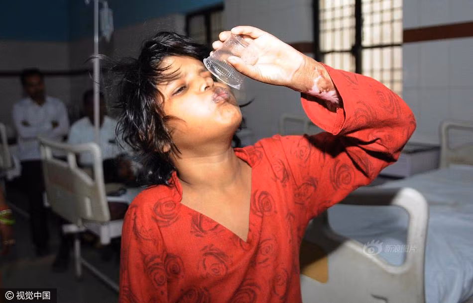 Cảnh sát cho biết, họ đã phải tấn công bầy khỉ để cứu cô bé đi. Khi đưa được cô bé lên xe, đàn khỉ đã đuổi theo không rời. (Nguồn Sina)