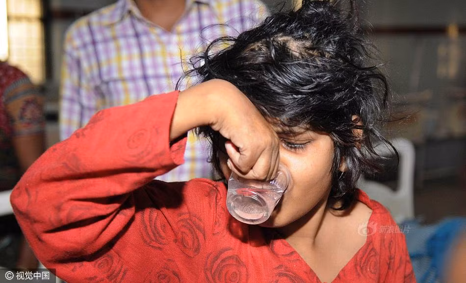 Do chỉ biết trò chuyện bằng những tiếng kêu, hú, đồng thời di chuyển bằng cả tứ chi, giống hệt như người rừng, nên cô bé được gọi là "cô bé Mowgli", theo tên nhân vật cậu bé người rừng được bầy sói nuôi dưỡng trong bộ phim bom tấn Jungle Book. (Nguồn Sina)