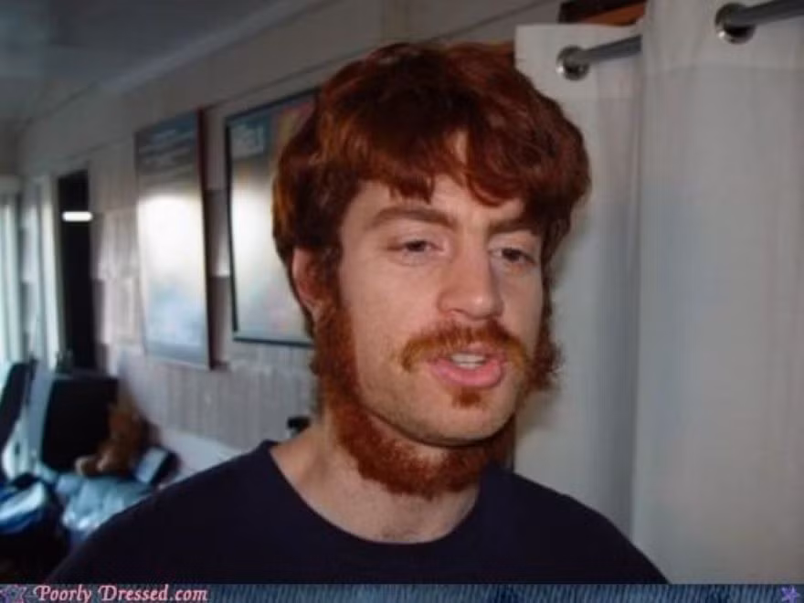 Kiểu râu quai nón rời hẳn ra khỏi cằm. Ảnh: Bodo.