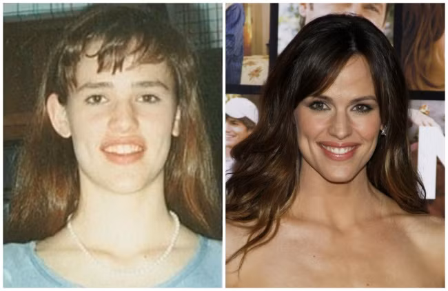 Những hình ảnh của người nổi tiếng khi còn nhỏ luôn thu hút được rất nhiều sự tò mò của công chúng. Trên đây là hình ảnh khác nhau hoàn toàn của Jennifer Anne Garner, nữ diễn viên nổi tiếng thường góp mặt trong các bộ phim hài.