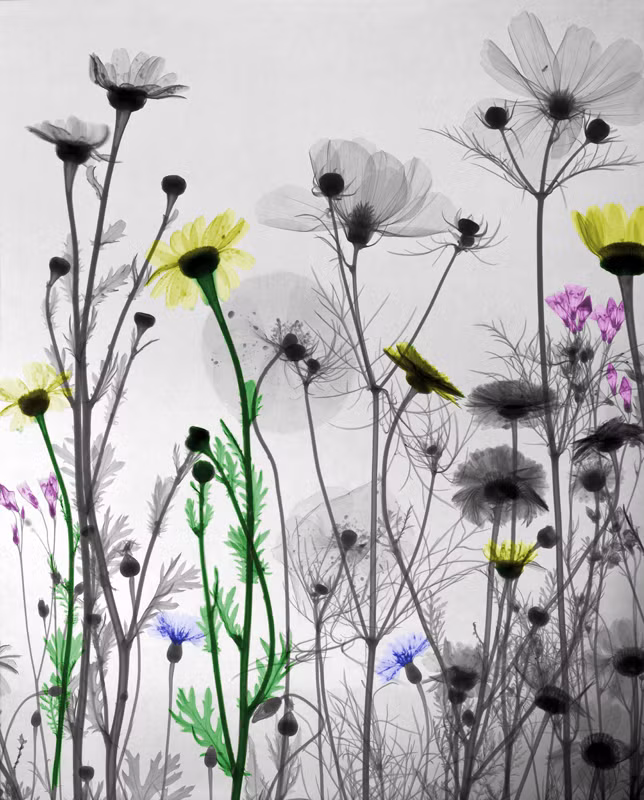 Thông thường, những bức ảnh X-quang sẽ chỉ mang lại 2 màu đen và trắng.