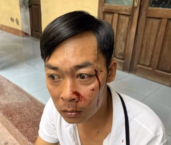 Dieu tra vu viec nguoi dan ong bi hanh hung khi vua roi tru so Toa an