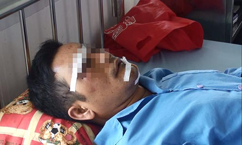 Cuong ghen, vac dao truy sat hang xom cua vo cu