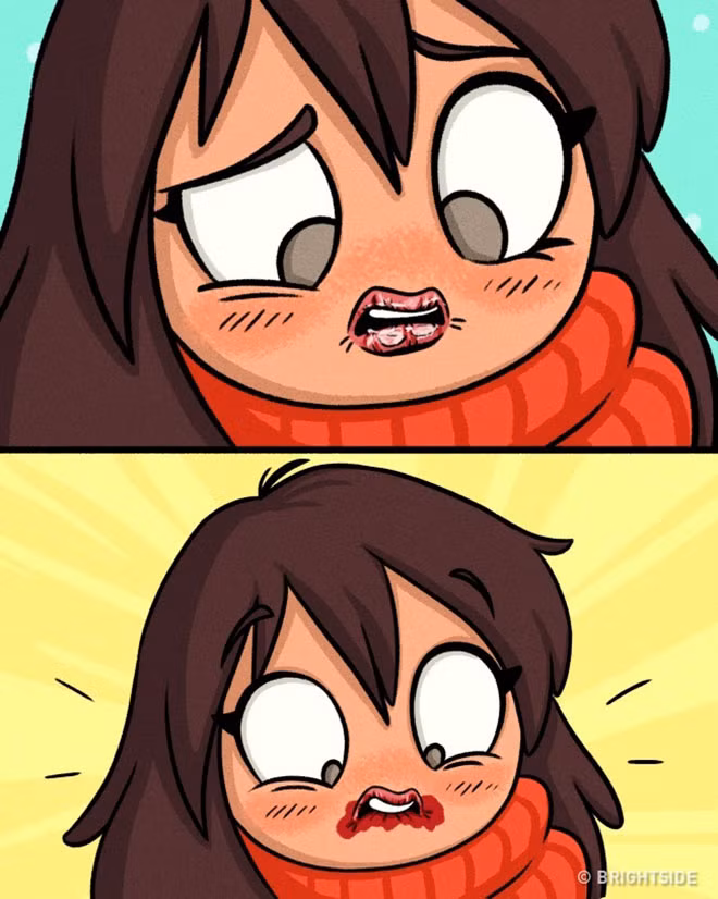 Khi bạn quên son dưỡng ẩm.