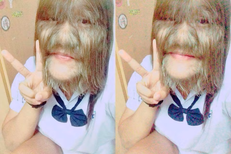 Gần đây, " cô gái mặt khỉ" đã quyết định cạo sạch lông mặt để thay đổi diện mạo mới. Cộng đồng mạng ở Thái Lan hết sức ngạc nhiên và tò mò thử xem, sau khi trút bỏ bộ lông, dung mạo thật của cô nàng sẽ như thế nào. Liệu cạo sạch lông có ảnh hưởng gì đến sức khỏe và cuộc sống của cô nàng hay không? Liệu sau bao lâu thì lông trên cơ thể cô nàng lại tiếp tục “sinh sôi nảy nở”.
