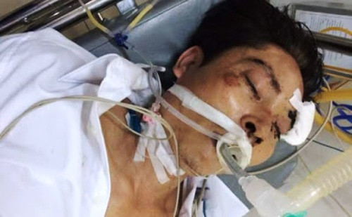 Hai Duong: Bi tam giam o cong an huyen, bong dung nguy kich