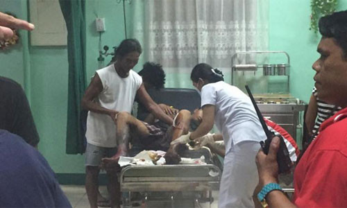 Một nam nạn nhân trong vụ nổ tối 28/12 đang được các bác sĩ chăm sóc vết thương. Ảnh sunstar