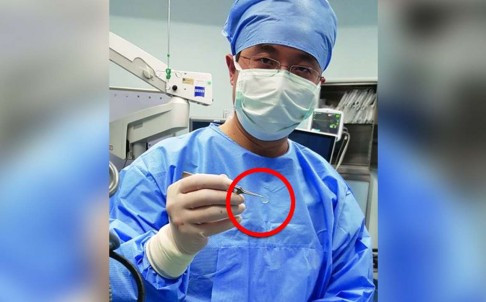 Cay ghep giac mac lon cho nguoi thanh cong-Hinh-2