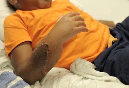 Tuy đôi bàn tay mới khiến cánh tay của cậu khá dị thường nhưng Zion vô cùng trân trọng: “Cháu mừng lắm. Cháu hãnh diện vì có đôi bàn tay này. Cháu có thể làm được mọi thứ mà không cần giúp đỡ. Đây thực sự là đôi tay dành cho cháu”.