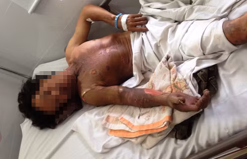 Nem chai xang tiem tam hoa vi…150.000: Ke thu ac bi tam than?