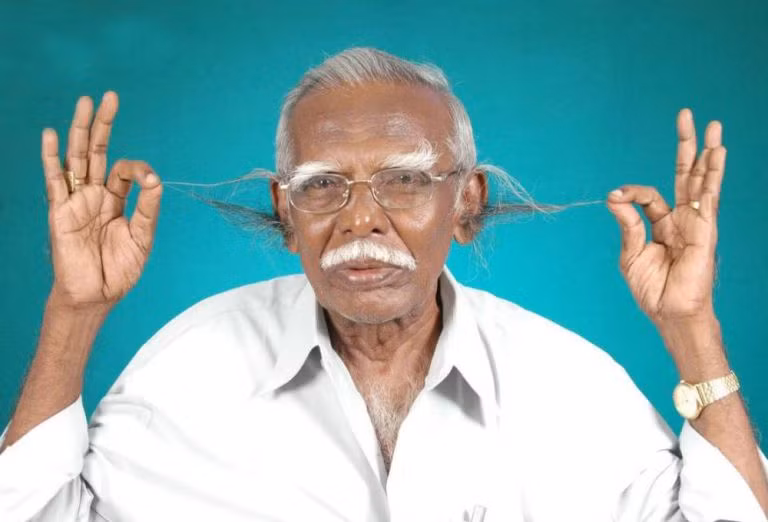 Anthony Victor, người đàn ông có lông tai dài nhất thế giới là một trong những kỷ lục kỳ quái nhất của thế giới.