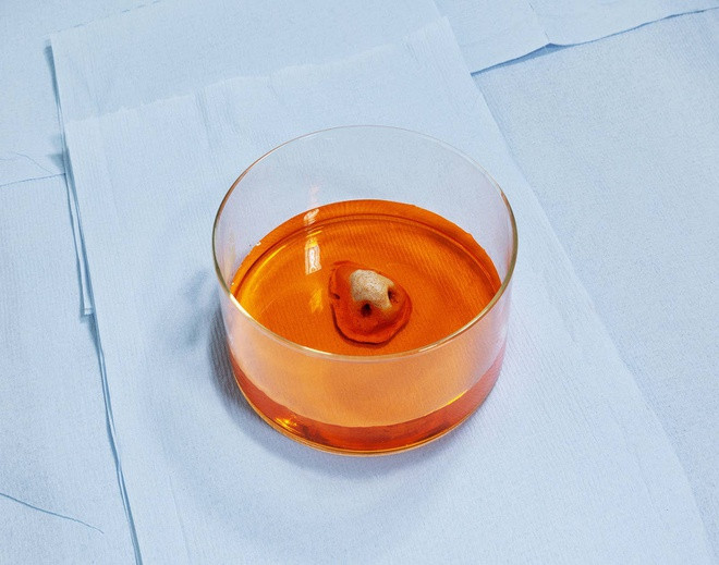 Chủ nghĩa này có thể phá vỡ tất cả các khía cạnh của cuộc sống: sức khỏe, văn hóa, chính trị và trí tuệ nhân tạo. Những công nghệ giúp tối ưu hóa hoặc thay đổi các bộ phận trên cơ thể sẽ tạo nên một cuộc cách mạng định hình lại loài người. Trong hình là chiếc mũi được Giáo sư Alexander Seifalian và nhóm của ông phát triển bằng tế bào gốc trong phòng thí nghiệm tại Đại học London.