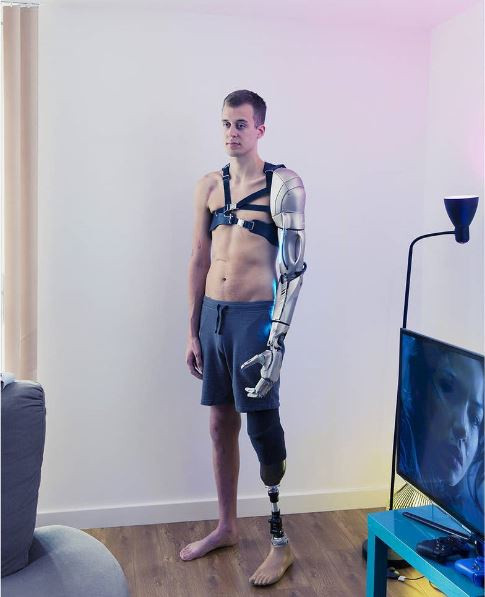 Một tai nạn khiến James Young mất một tay và một chân. Anh đã tái tạo các chi của mình bằng bộ phận sinh học. Lấy cảm hứng từ trò chơi máy tính Metal Gear Solid, công ty Konami và nhà điêu khắc chân tay giả Sophie De Oliveira Barata đã hoàn thiện cơ thể cho James.