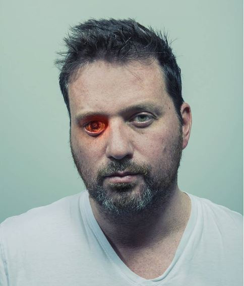 Rob Spence, hay còn được biết đến với cái tên The Eyeborg, bị mất một mắt từ nhỏ. Ông đã tạo ra một con mắt sinh học có gắn máy quay không dây bên trong.