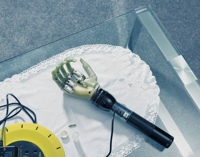 Cánh tay robot của Kevin Warrick.