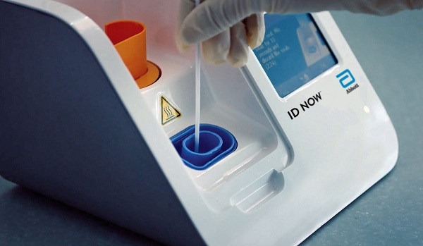 Vốn là một cường quốc nhanh nhạy với mọi lĩnh vực, Mỹ nhanh chóng đưa ra các sản phẩm xét nghiệm nhanh SARS-CoV-2 để phục vụ cho y tế. Mới đây, Cục Quản lý Thực phẩm và Dược phẩm Mỹ (FDA) vừa phê duyệt khẩn cấp bộ test Covid-19 do công ty thiết bị y tế Abbott phát triển, cho kết quả xét nghiệm chỉ sau 5 phút.