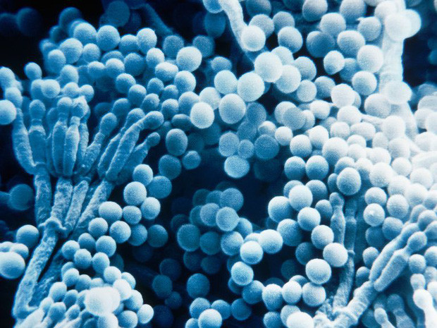 Năm 1896, Ernest Duchesne đã từng sử dụng nấm mốc Penicillium để chữa trị bệnh thương hàn ở chuột lang. Tuy nhiên, thời đó, các nhà khoa học chưa xem xét một cách nghiêm túc về công trình này nên Duchesne chưa bao giờ nhận được bằng sáng chế. Mãi cho tới năm 1928, Alexander Fleming mới phát hiện ra những mảng vi khuẩn nằm xung quanh tảng nấm bị phá hủy.