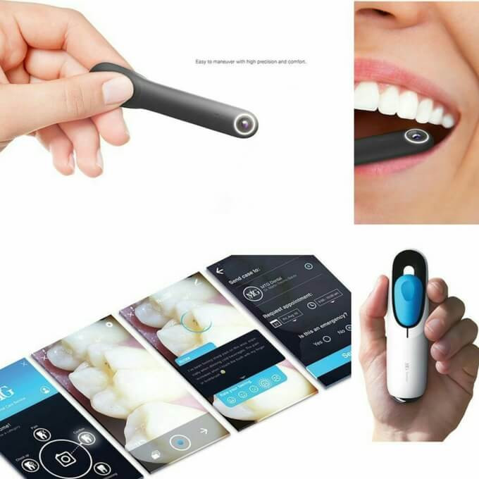 Dụng cụ khám răng tại nhà MTG Dental Camera là thiết bị được tạo ra để chẩn đoán tình trạng răng của bạn, nó sẽ giúp chụp hình chiếc răng đang bị thương tổn của bạn rồi gửi đến bác sĩ thông qua một ứng dụng đặc biệt trên di động.