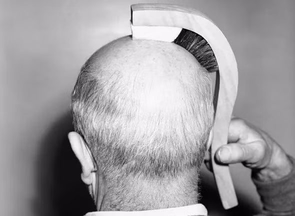 Chiếc lược kỳ lạ dành riêng cho người hói này được cấu tạo dạng bàn chải với 1 phần là bàn chải và 1 phần đệm mút. Phần bàn chải sẽ giúp người dùng làm sạch da đầu và phần đệm mút sẽ xoa bóp da đầu của họ. Sản phẩm này được phát minh bởi công ty Los Angeles Brush Manufacturing vào năm 1950.