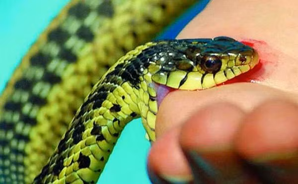 Nọc rắn là một trong số những chất cực độc, có thể giết người chỉ trong vài giây. Chắc hẳn con người gây thù hấn với loài rắn quá nhiều, ít nhất 50.000 người bỏ mạng vì bị rắn cắn.