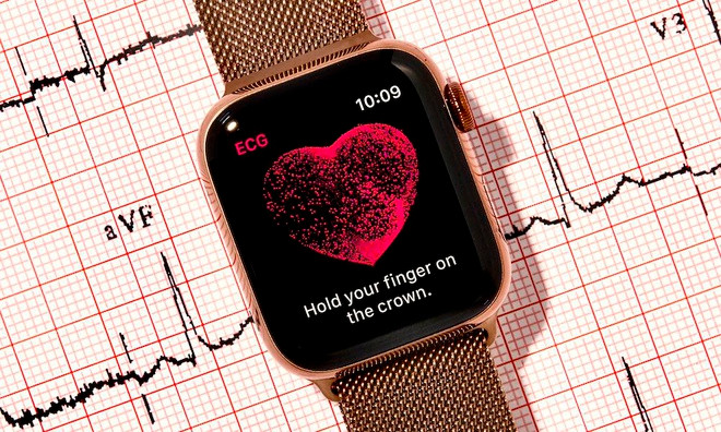 Watch SE thiếu tính năng ECG cho phép theo dõi điện tâm đồ, cảnh báo nhồi máu cơ tim. Tuy vậy, Watch SE vẫn có thể đo nhịp tim giống như Series 3, nhưng sẽ chỉ thông báo nếu như bạn có nhịp tim cao, thấp bất thường.